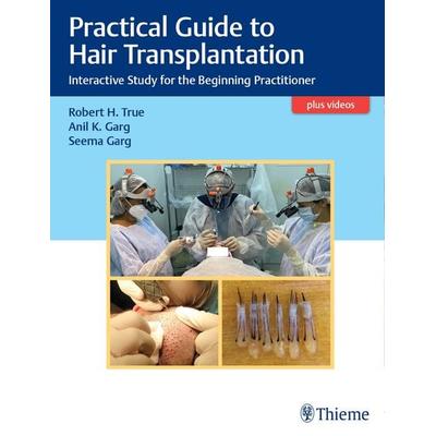 Practical Guide to Hair Transplantation, Gebundene Ausgabe von Robert True,Anil Garg,Seema Garg, Thieme Medical Publishers, 978-93-90553-24-2