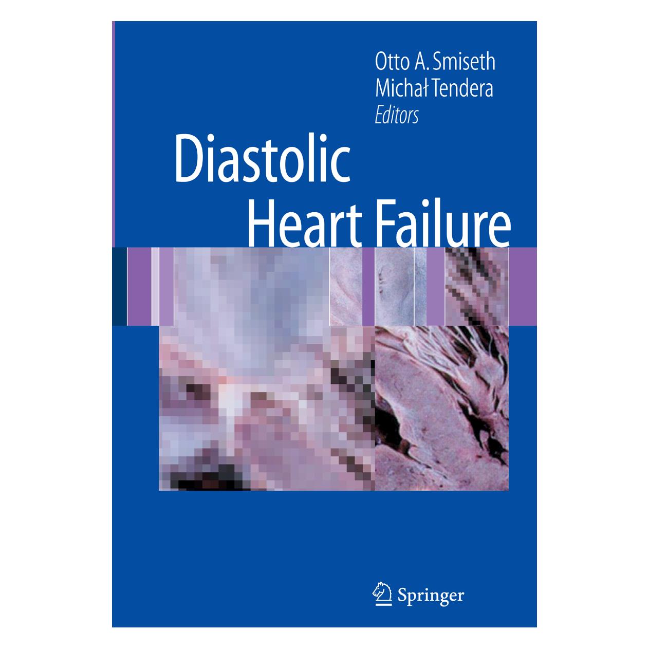 Springer Diastolic Heart Failure (Englisch, Softcover, Michal Tendera, Otto A. Smiseth) (55381639)
