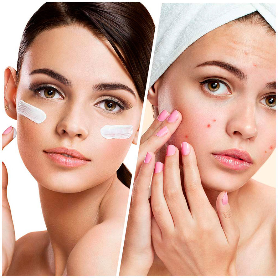 Biovene Blemish Control clear complexion facial moisturizer lotion 50 ml