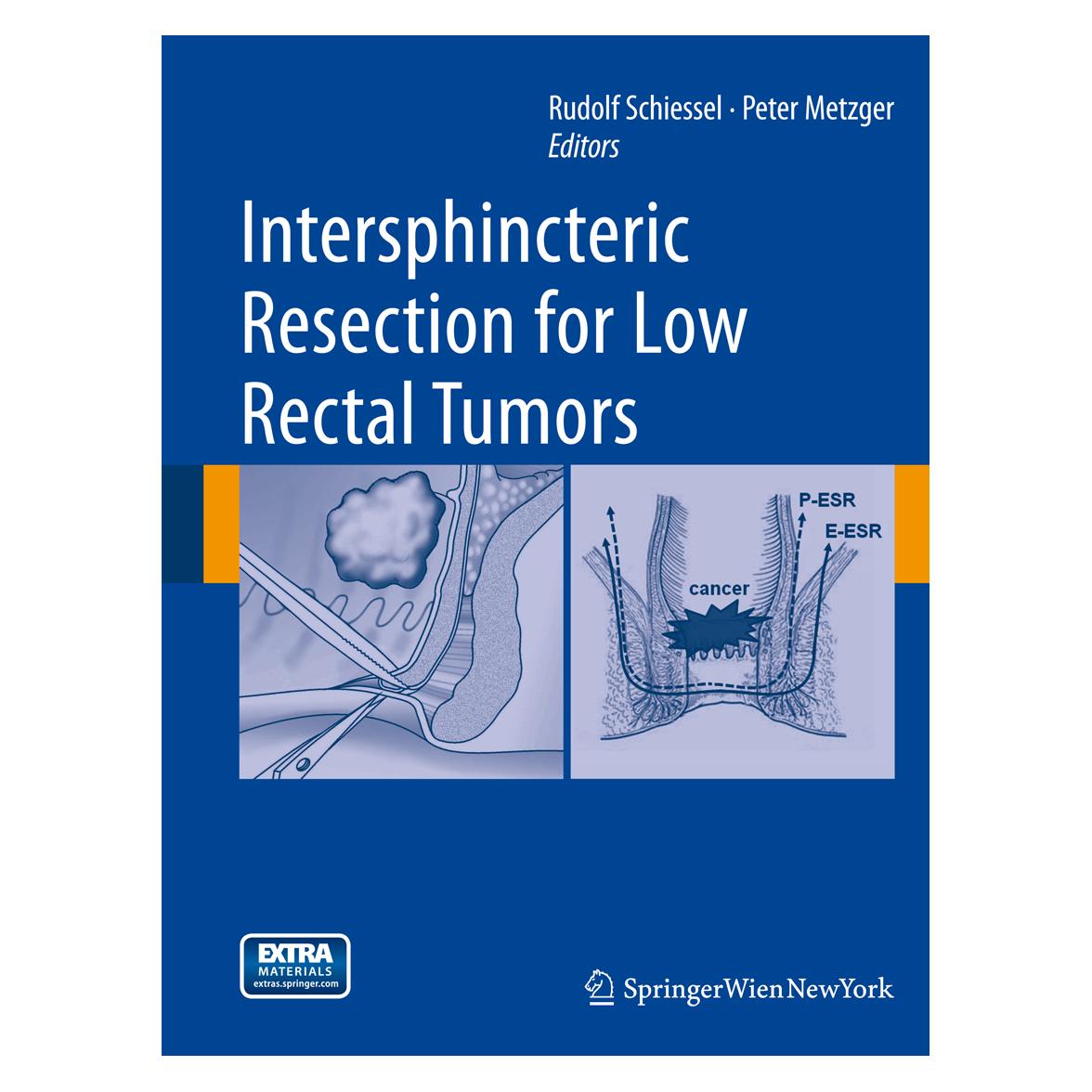 Springer Intersphincteric Resection for Low Rectal Tumors (Englisch, Softcover, Peter Metzger, Rudolf Schiessel) (55556131)