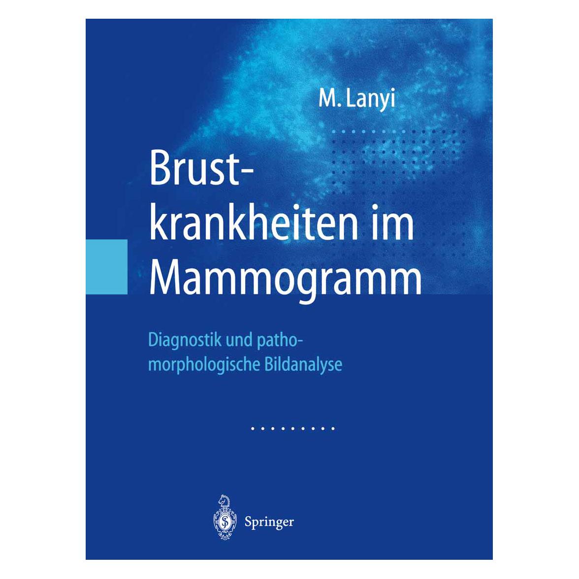 Springer Brustkrankheiten im Mammogramm (Deutsch, Softcover, Marton Lanyi) (55562336)