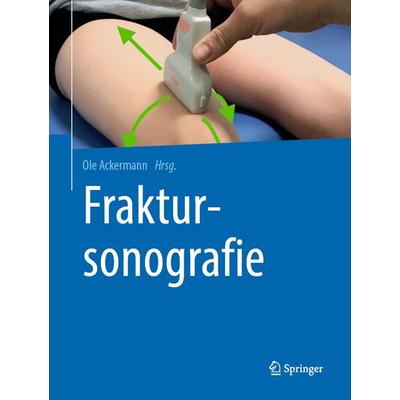 Fraktursonografie, Gebundene Ausgabe von , Springer Berlin, 978-3-662-58507-8