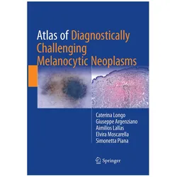 Atlas of Diagnostically Challenging Melanocytic Neoplasms, Fachbücher von Giuseppe Argenziano, Aimilios Lallas, Simonetta Piana, Caterina Longo, Elvira Moscarella, Aimilios et al Lallas