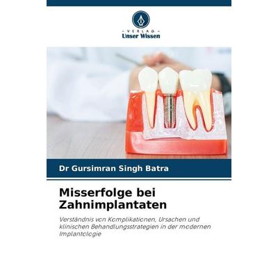 Misserfolge bei Zahnimplantaten, Taschenbuch von Gursimran Singh Batra, Verlag Unser Wissen, 978-620-2-36662-5