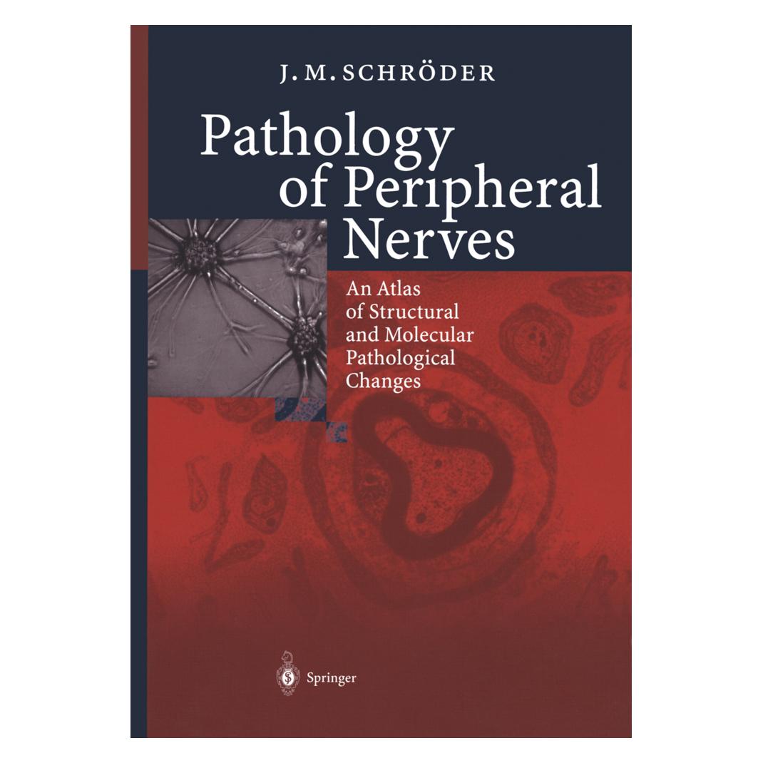 Springer Pathology of Peripheral Nerves (Englisch, Softcover, J M Schröder, J.-M. Schröder, J.M. Schröder) (55530043)