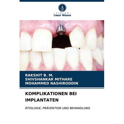 Komplikationen bei Implantaten, Taschenbuch von Rakshit B. M.,Shivshankar Mithare,Mohammed Nashiroddin, Verlag Unser Wissen, 978-620-7-12200-4