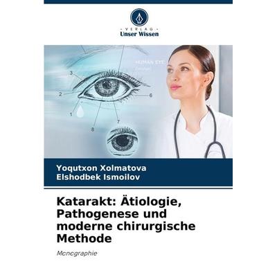 Katarakt: Ätiologie, Pathogenese und moderne chirurgische Methode, Taschenbuch von Yoqutxon Xolmatova,Elshodbek Ismoilov, Verlag Unser Wissen,