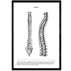 POSTER Anatomie Wirbelsäule A3 Schwarzer Rahmen