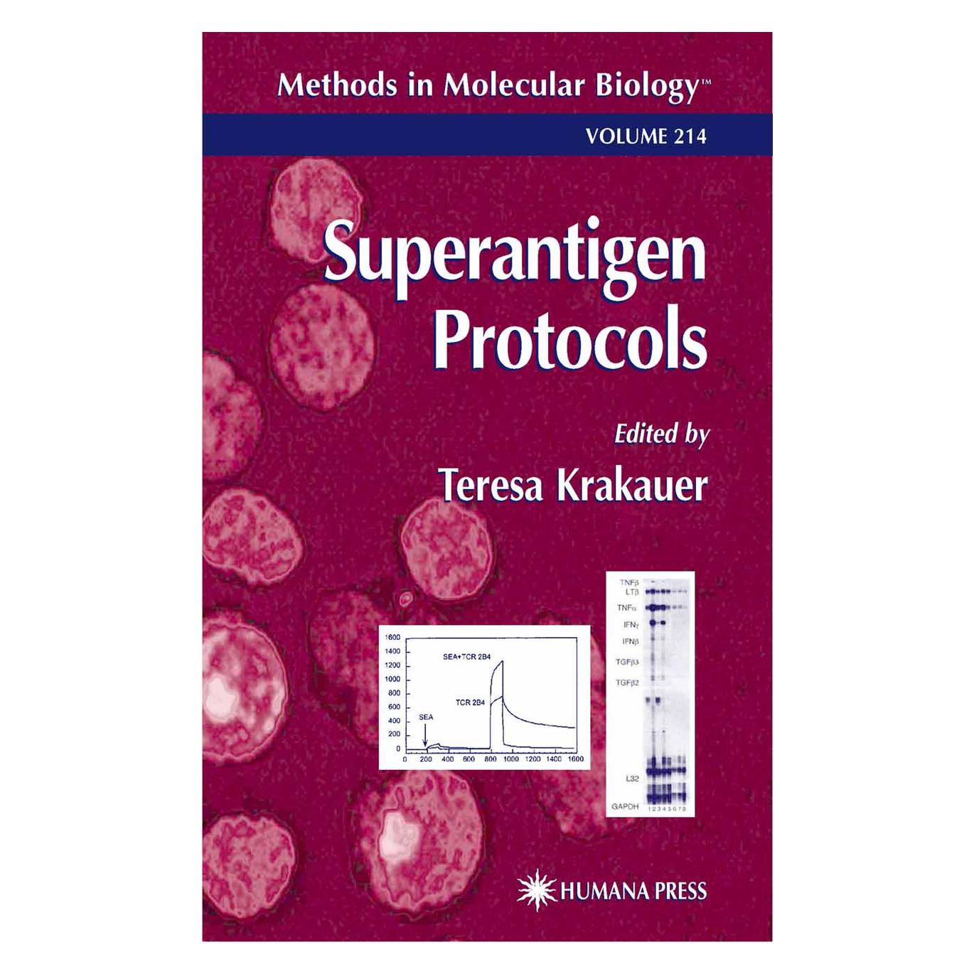 Springer Superantigen Protocols (Englisch, Softcover, Teresa Krakauer) (55560060)