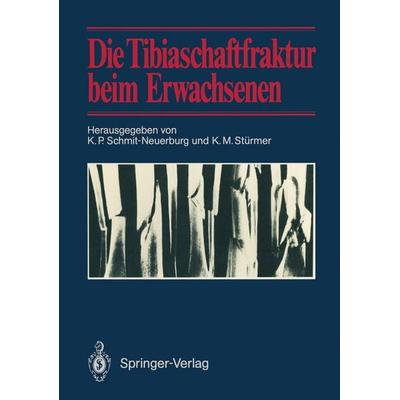 Die Tibiaschaftfraktur beim Erwachsenen, Taschenbuch von , Springer Berlin, 978-3-642-71560-0