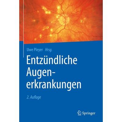 Entzündliche Augenerkrankungen, Gebundene Ausgabe von , Springer Berlin, 978-3-662-60398-7
