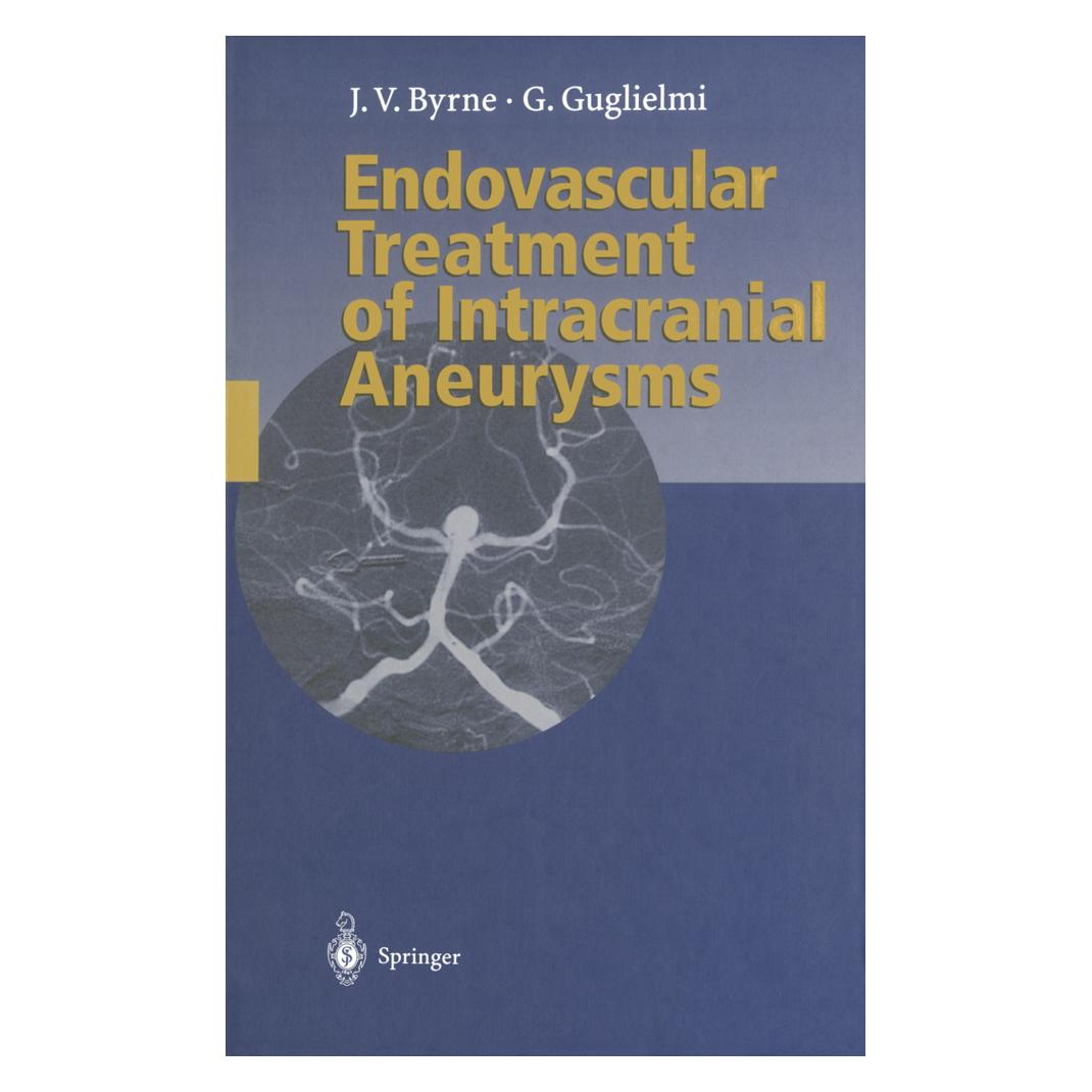Springer Endovascular Treatment of Intracranial Aneurysms (Englisch, Softcover, Guido Guglielmi, James Byrne) (55506644)