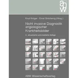 Nicht invasive Diagnostik angiologischer Krankheitsbilder, Fachbücher von Ernst Gröchenig, Knut Kröger