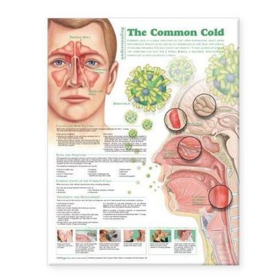Understanding the Common Cold Anatomical Chart, Nonbook von , Wolters Kluwer Health, 978-0-7817-8631-7