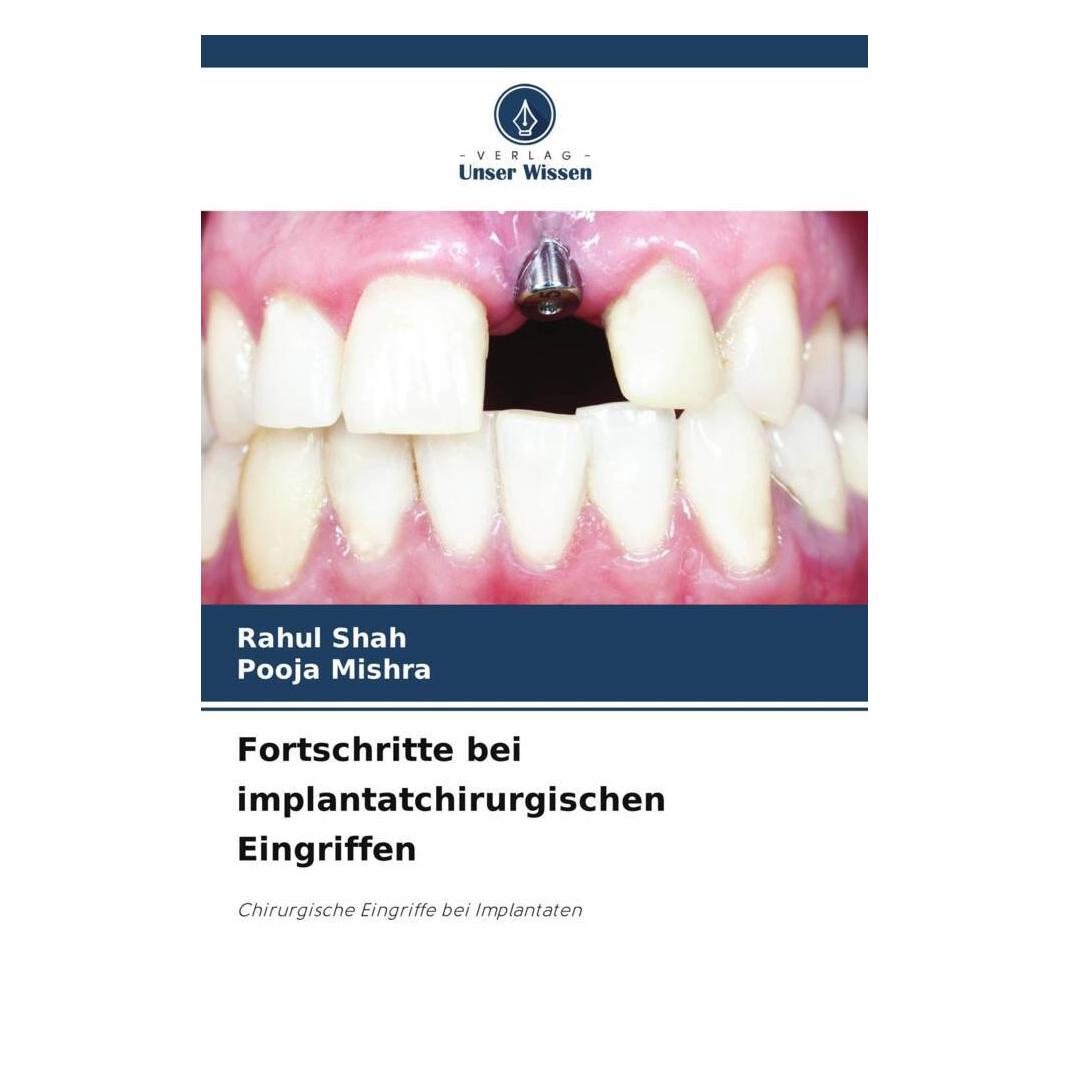 Unser Wissen Fortschritte bei implantatchirurgischen Eingriffen (57068155)