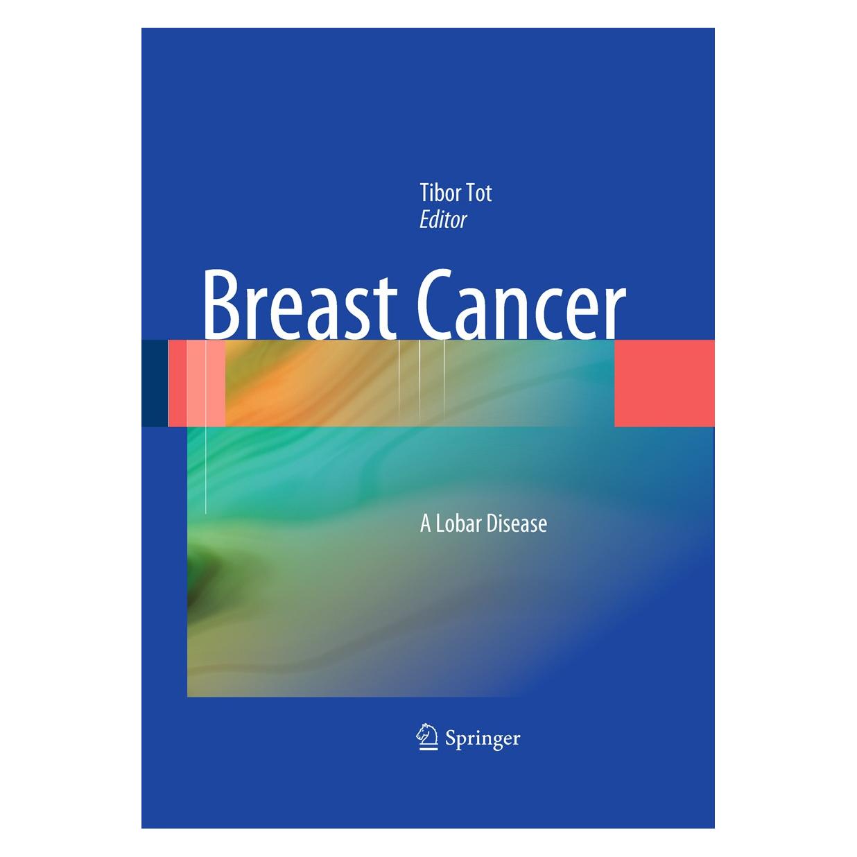 Springer Breast Cancer (Englisch, Hardcover, Tibor Tot) (9781849963138)