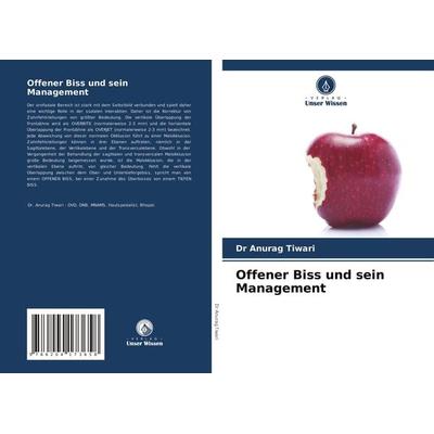 Offener Biss und sein Management, Taschenbuch von Anurag Tiwari, Verlag Unser Wissen, 978-620-4-17365-8