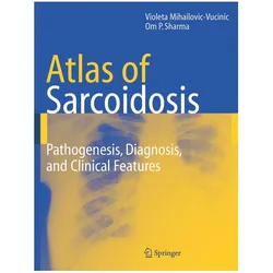 Atlas of Sarcoidosis, Fachbücher von Violeta Mihailovic-Vucinic, Om P Sharma