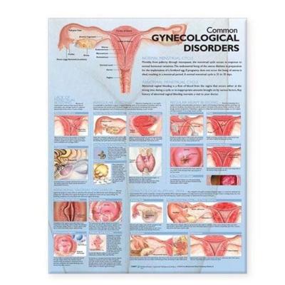 Common Gynecological Disorders Anatomical Chart, Nonbook von , Ingram Publishers Services, 978-0-7817-7351-5