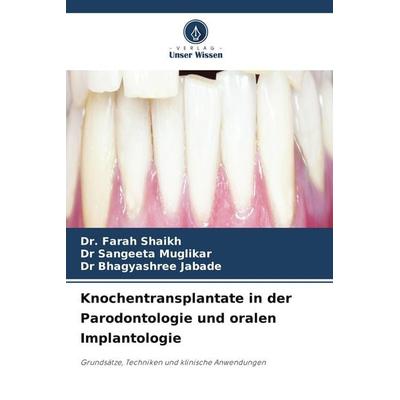 Knochentransplantate in der Parodontologie und oralen Implantologie, Taschenbuch von Farah Shaikh,Sangeeta Muglikar,Bhagyashree Jabade, Verlag Unser