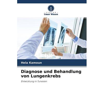 Diagnose und Behandlung von Lungenkrebs, Taschenbuch von Hela Kamoun, Verlag Unser Wissen, 978-620-4-29688-3