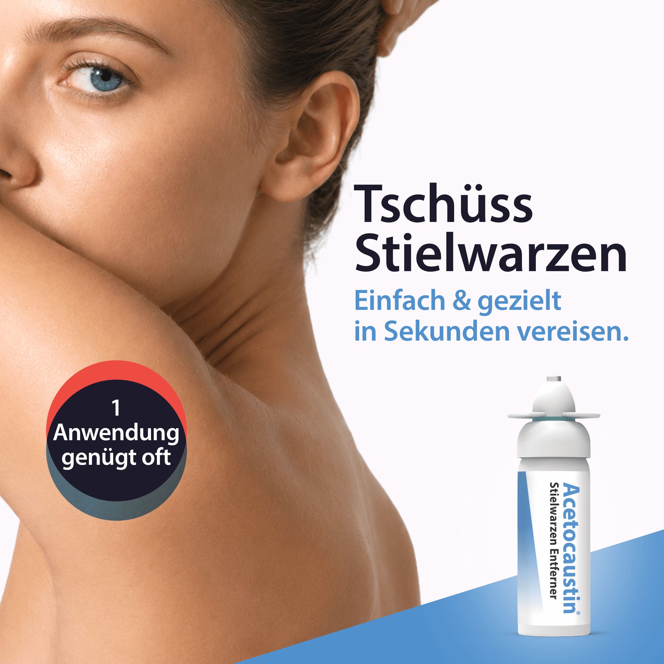 Acetocaustin Stielwarzen Entferner Stift 50 ml Stifte