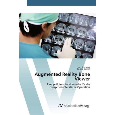 Augmented Reality Bone Viewer, Taschenbuch von Lars Schnyder,Lorenz Grimm, AV Akademikerverlag, 978-3-639-38180-1