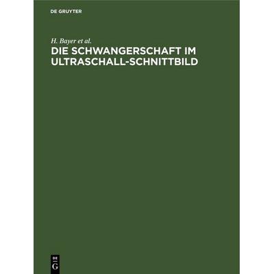 Die Schwangerschaft im Ultraschall-Schnittbild, Gebundene Ausgabe von H. Bayer,R. Schulte,P. Prenzlau,R. Lüder, De Gruyter, 978-3-11-265197-1