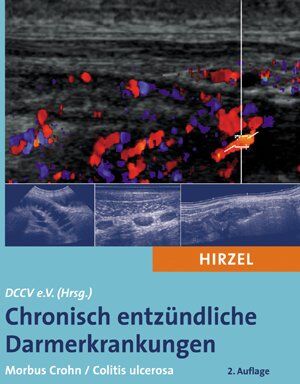Tilo Andus - Chronisch entzündliche Darmerkrankungen: Morbus Crohn / Colitis ulcerosa - Preis vom 09.10.2026 07:28:09 h
