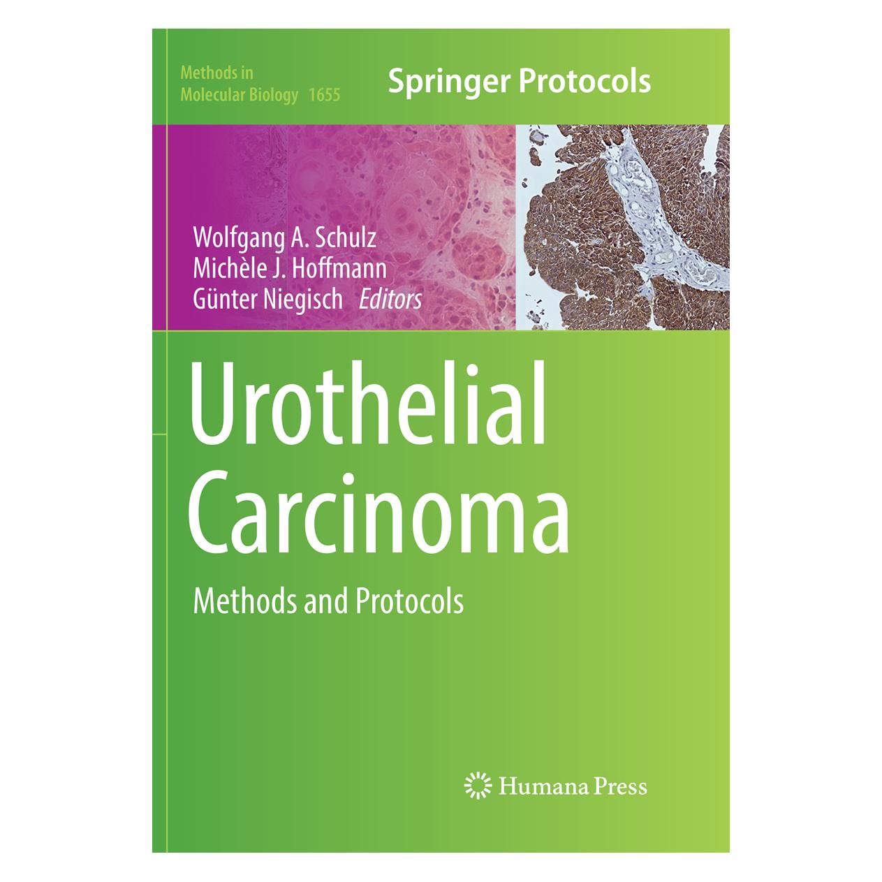 Springer Urothelial Carcinoma (Englisch, Softcover, Günter Niegisch, Michèle J. Hoffmann, Wolfgang A. Schulz) (56053881)