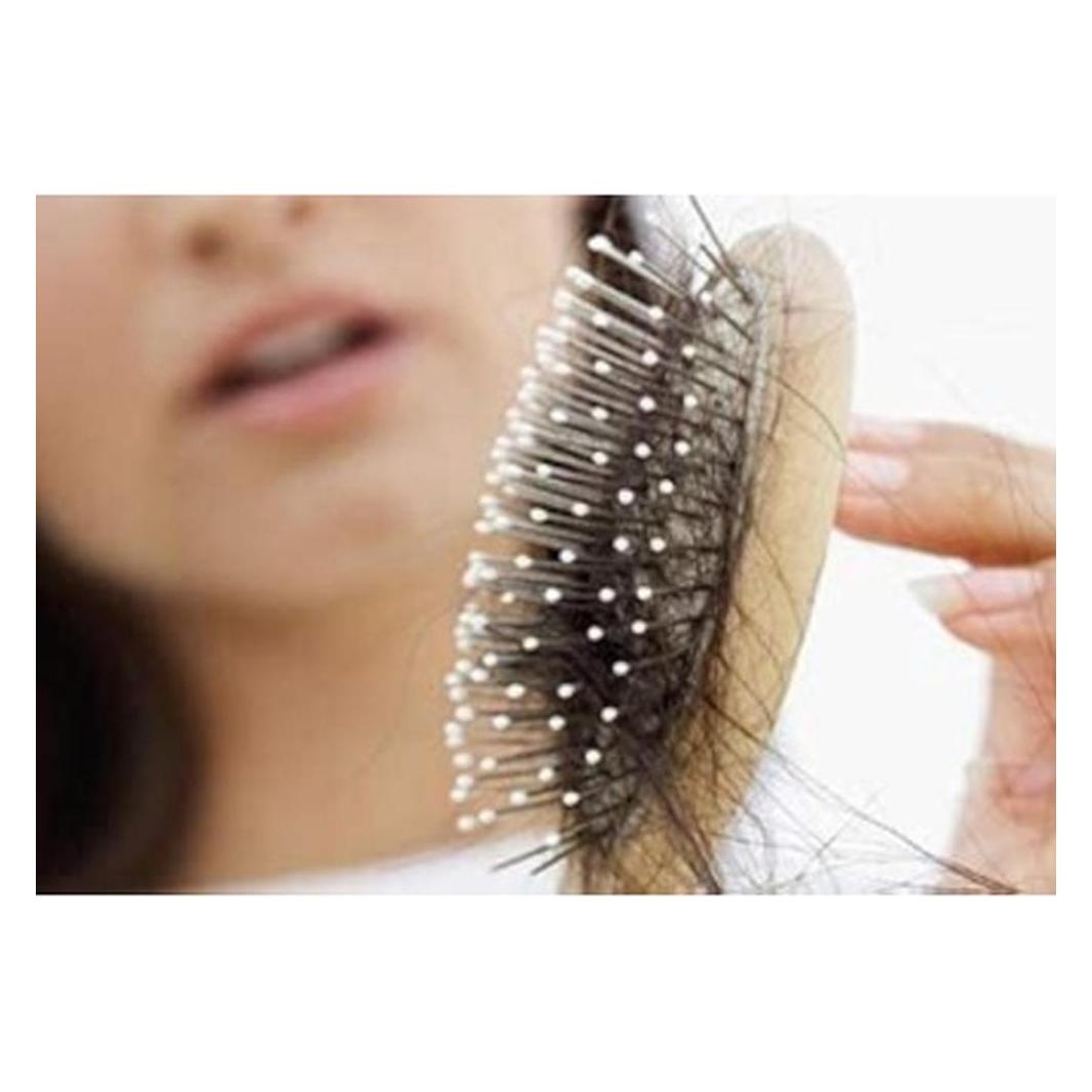 Farmona Radical Hair Loss (Körperlotion, 75 ml) (24706300)