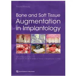 BoneandSoftTissueAugmentationinImplantology, Fachbücher von Fouad Khoury