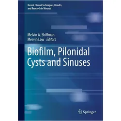 Biofilm, Pilonidal Cysts and Sinuses, Fachbücher von Melvin A. Shiffman, Mervin Low