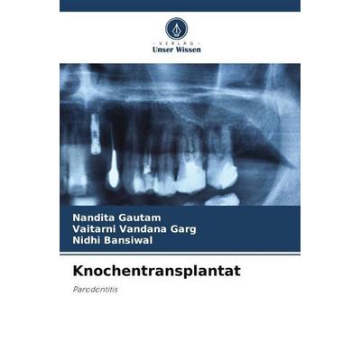 Knochentransplantat, Taschenbuch von Nandita Gautam,Vaitarni Vandana Garg,Nidhi Bansiwal, Verlag Unser Wissen, 978-620-5-05113-9