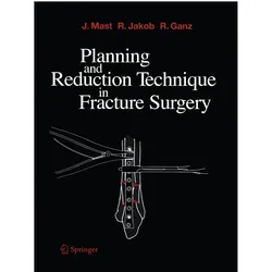 Planning and Reduction Technique in Fracture Surgery, Fachbücher von Reinhold Ganz, Roland Jakob, Jeffrey Mast