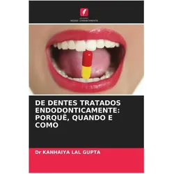 De Dentes Tratados Endodonticamente: Porquê, Quando E Como, Ratgeber von Dr KANHAIYA LAL GUPTA