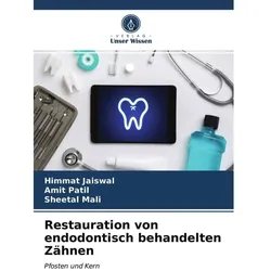 Unser Wissen, Zubehör Zahnpflege, Restauration von endodontisch behandelten Zähnen