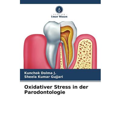 Oxidativer Stress in der Parodontologie, Taschenbuch von Kunchok Dolma J.,Sheela kumar Gujjari, Verlag Unser Wissen, 978-620-5-08087-0
