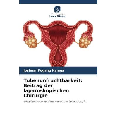 Tubenunfruchtbarkeit: Beitrag der laparoskopischen Chirurgie, Taschenbuch von Josimar Fogang Kamga, Verlag Unser Wissen, 978-620-3-64440-1