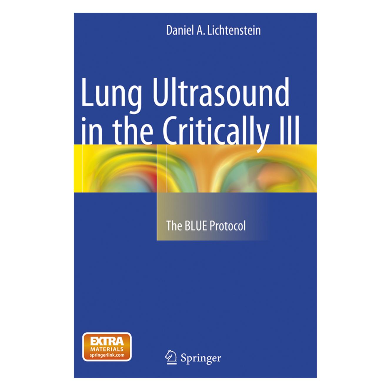 Springer Lung Ultrasound in the Critically Ill (Englisch, Softcover, Daniel A. Lichtenstein) (56006656)