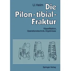 Die Pilon-tibial-Fraktur, Fachbücher von Urs Heim