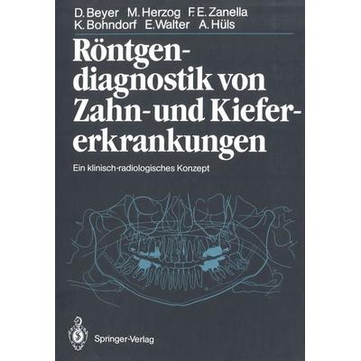 Röntgendiagnostik von Zahn- und Kiefererkrankungen, Taschenbuch von Dieter Beyer,Michael Herzog,Friedhelm Zanella,Klaus Bohndorf,Eberhard Walter,