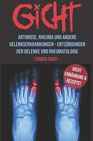 Torben Trost - Gicht Arthrose, Rheuma, und andere Gelenkserkrankungen – Entzündungen der Gelenke und Rheumatologie Gicht Ernährung und Rezepte - Preis vom 30.09.2026 09:01:18 h