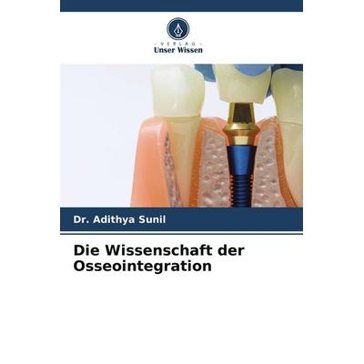 Die Wissenschaft der Osseointegration, Taschenbuch von Adithya Sunil, Verlag Unser Wissen