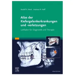 Atlas Kiefergelenkerkrankungen und -ver, Fachbücher von Rudolf H Reich, Andreas Neff