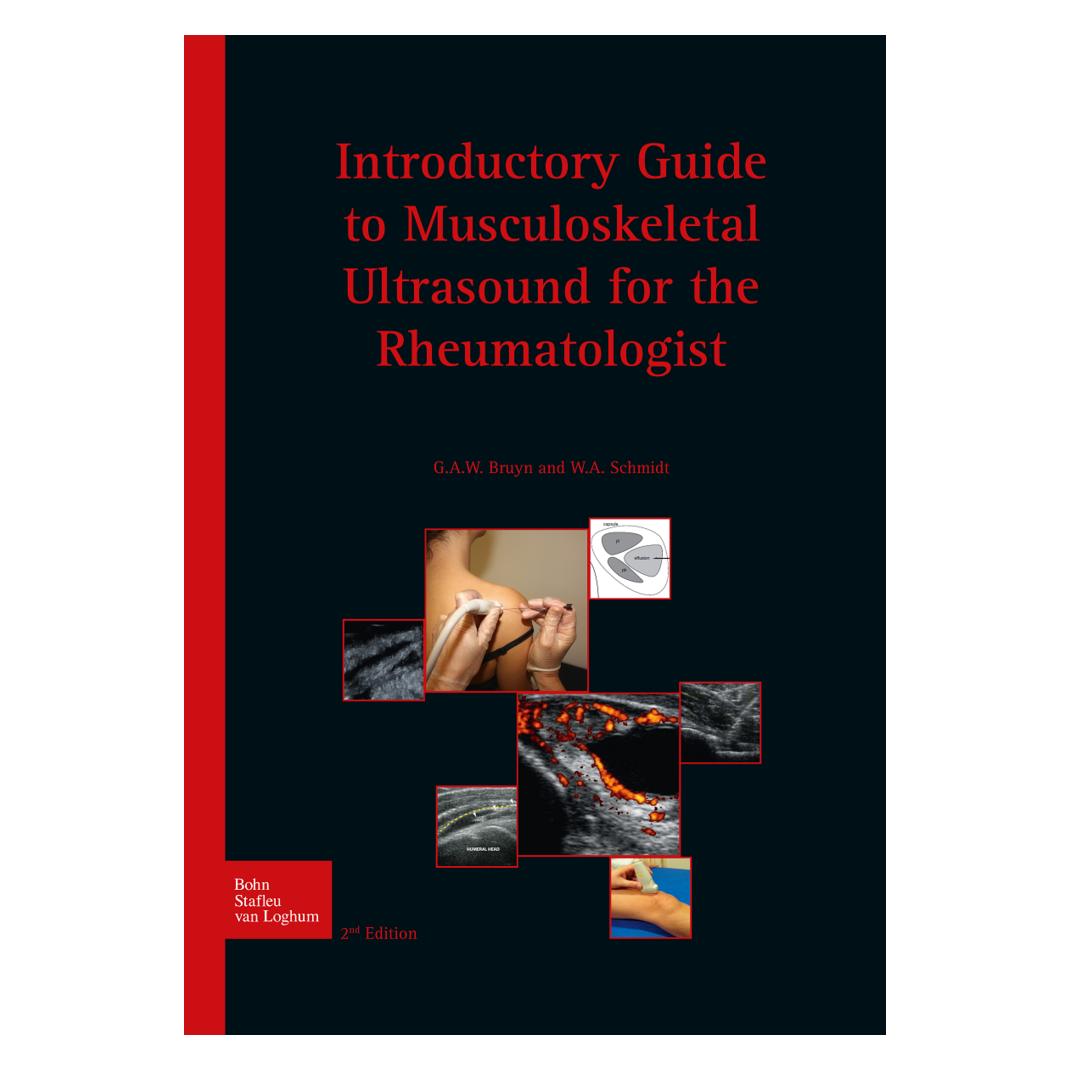 Springer Introductory guide to musculoskeletal ultrasound for the rheumatologist (Englisch, Softcover, G. A. W. Bruyn, W.A. Schmidt) (55576179)