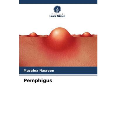 Pemphigus, Taschenbuch von Musaina Nasreen, Verlag Unser Wissen, 978-620-4-69360-6