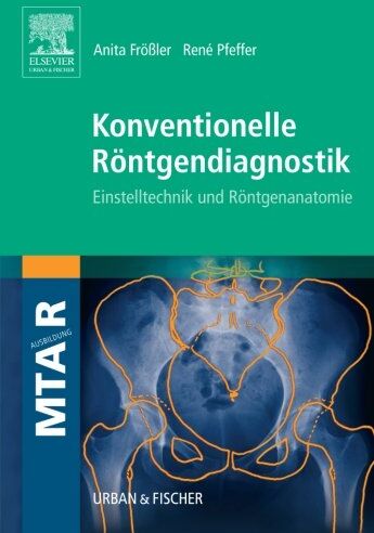 Anita Frößler - Konventionelle Röntgendiagnostik: Einstelltechnik und Röntgenanatomie - Preis vom 30.09.2026 09:01:18 h