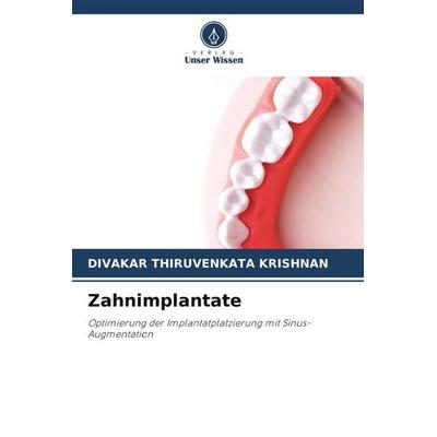 Zahnimplantate, Taschenbuch von Divakar Thiruvenkata Krishnan, Verlag Unser Wissen, 978-620-6-00151-5