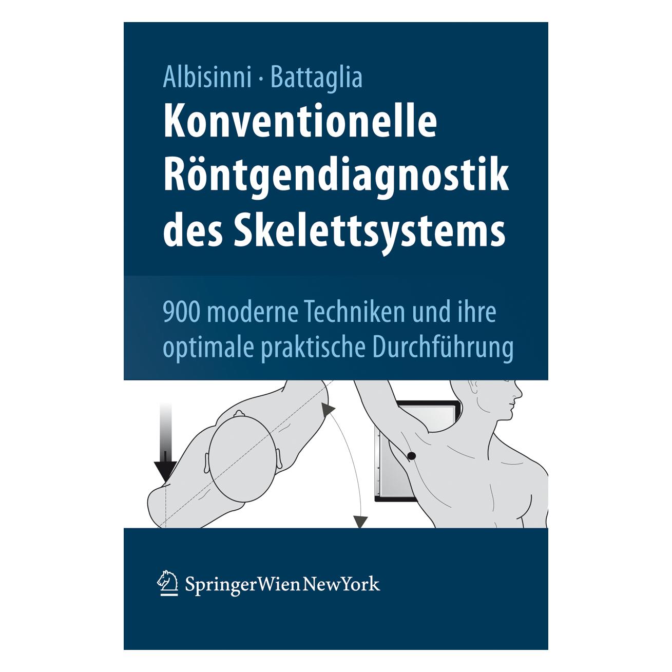 Springer Konventionelle Röntgendiagnostik des Skelettsystems (Deutsch, Softcover, Milva Battaglia, Ugo Albisinni) (55188155)